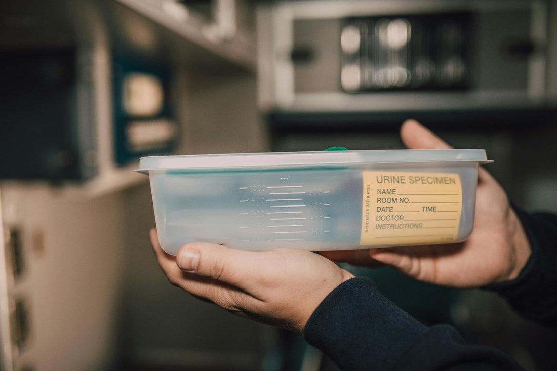 Does THCA Show Up on a Drug Test?